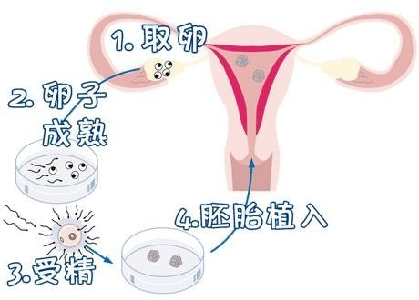 代生男孩价格